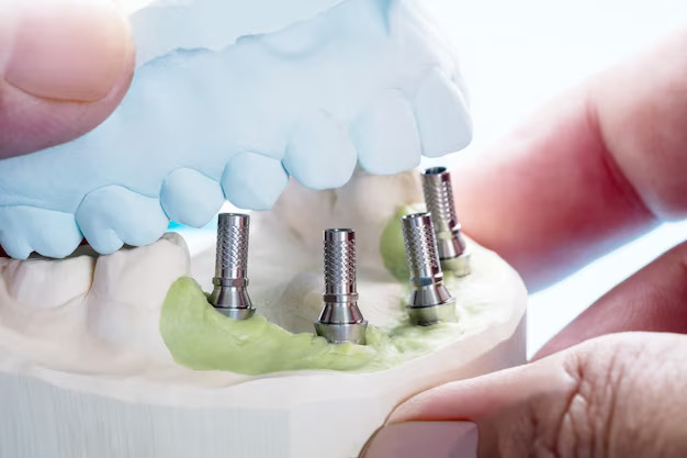 dental crown and bridges treatment in kolkata at smile signature dental clinic